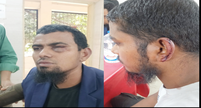 সোনারগাঁয়ের সনমান্দিতে জামায়াত কর্মীদের ওপর হামলা ও হয়রানির অভিযোগ