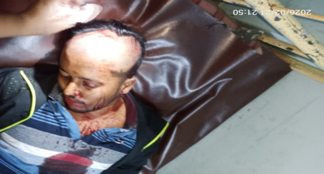 জমি থেকে ইটভাটায় মাটি নিতে বাধা, সংঘর্ষে আহত ২০