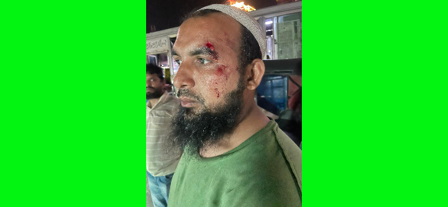 সোনারগাঁয়ে গরুর মাংস ব্যবসায়ীর ১০ লাখ টাকা ছিনতাই, আহত ৩