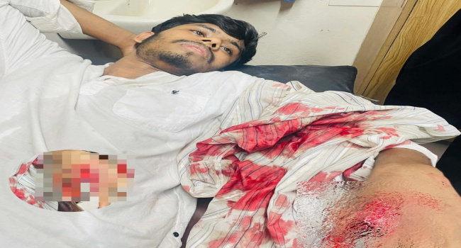 তুচ্ছ ঘটনায় সংঘর্ষ: সোনারগাঁয়ে যুবককে কুপিয়ে গুরুতর জখম